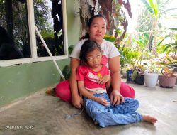 Mengenaskan ! Anak Kekurangan Gizi di Desa Girijaya Kecamatan Kiara, Kurang Mendapatkan Perhatian